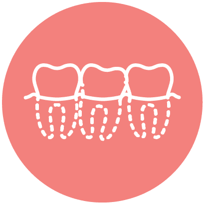 Hello Ortho Crowded Teeth