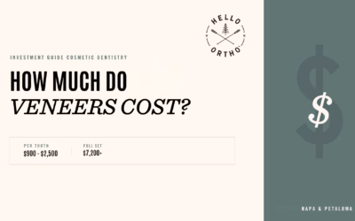 How Much Do Veneers Cost in 2026?
