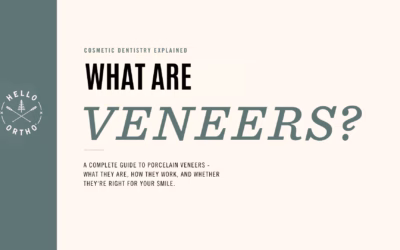 What Are Dental Veneers?